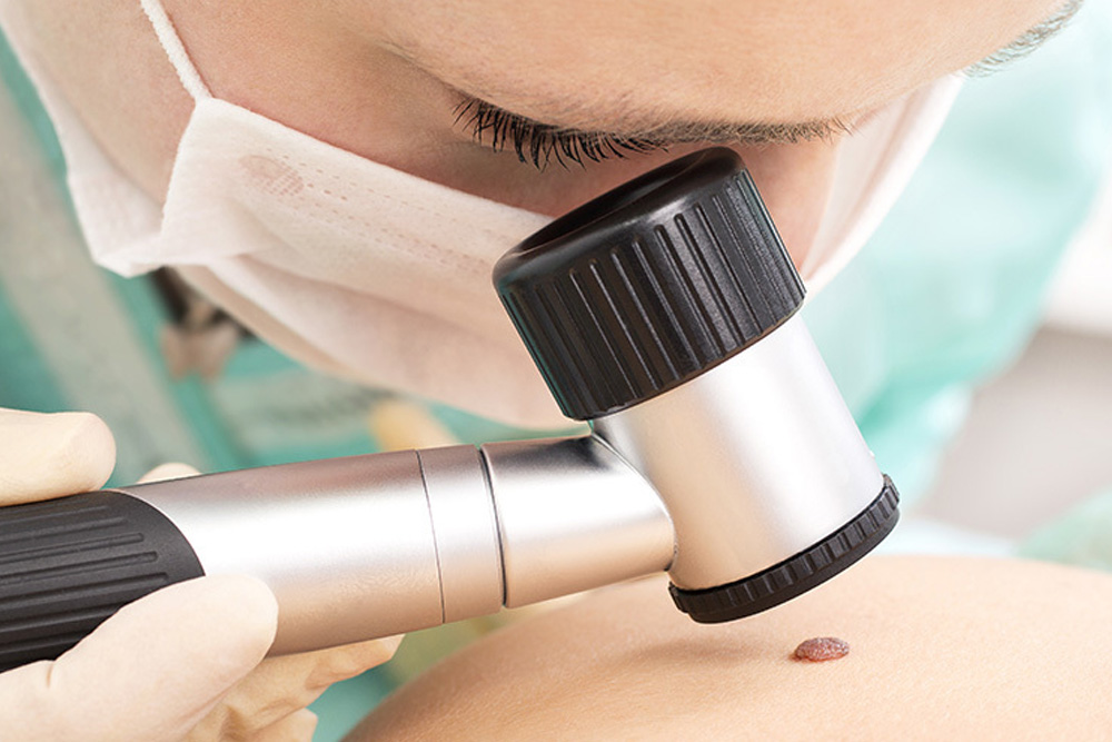 About Micrographic Surgery