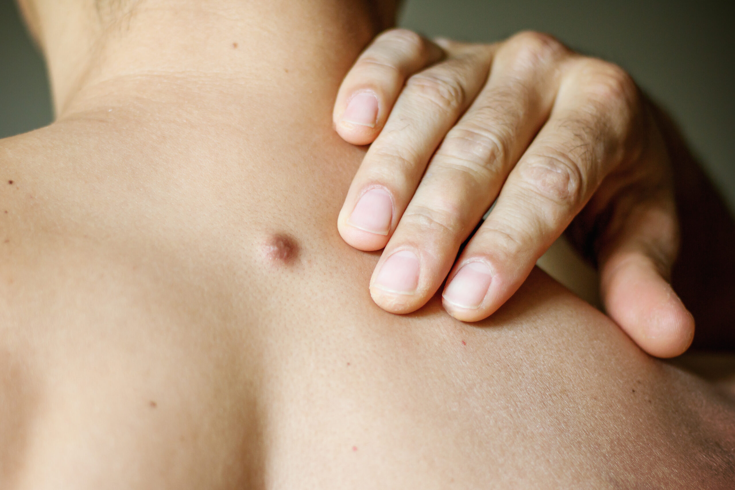 Cysts