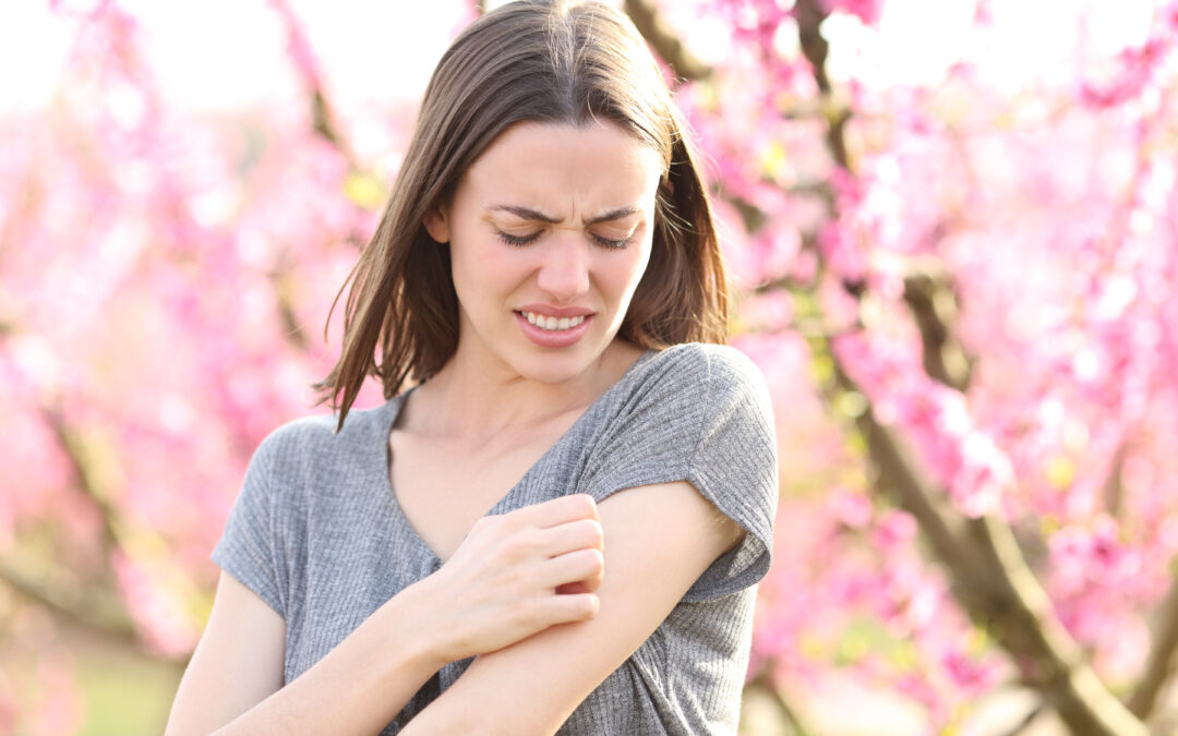 Allergies and Your Skin: How to Manage Springtime Irritations